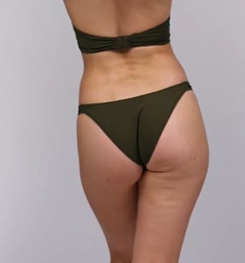 Lita bikinitrusse brasiliansk